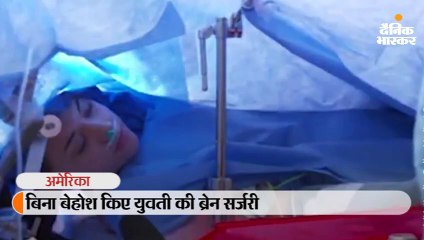 बिना बेहोश किए युवती की ब्रेन सर्जरी