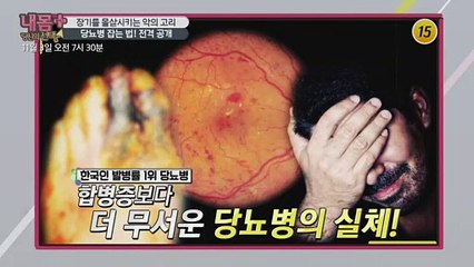 장기를 몰살시키는 악의 고리, 당뇨병 잡는 법! 전격 공개_내 몸 플러스 169회 예고