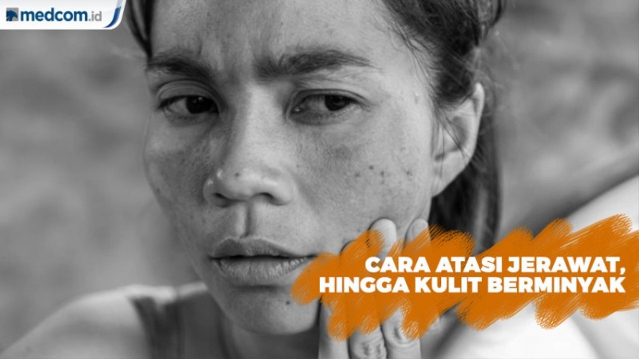 Cara Atasi Jerawat, Kulit Mengelupas hingga Kulit Berminyak
