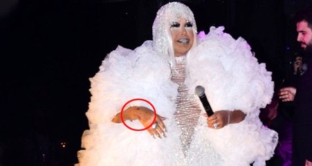 Şarkıcı Bülent Ersoy'un moraran elleri herkesi korkuttu