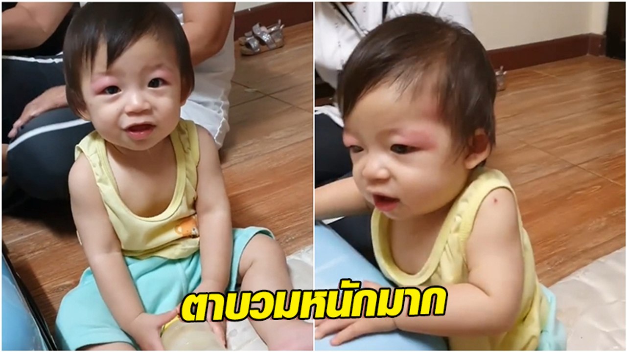 ต้นหอม ปวดใจ น้องปกป้อง ตาบวมแดง คาดแพ้อากาศที่พิษณุโลก