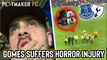 Reactions | Andre Gomes injury: A fan's eye view of the moment Everton star suffered horrific leg break against Spurs