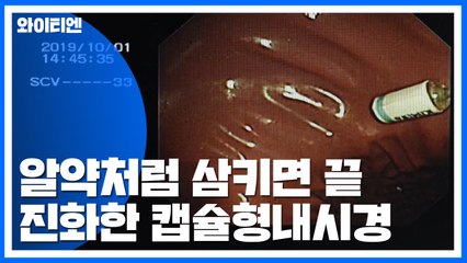 알약처럼 삼키면 진단에 치료까지...진화한 캡슐형내시경 / YTN