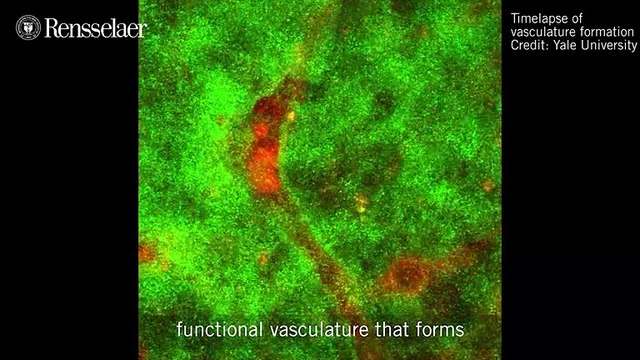 Scientists Create 3D Printed Skin With Blood Vessels