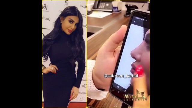 فيديو أمل العوضي تخضع لعملية تجميل جديدة.. وهذا ما تغير بشكلها