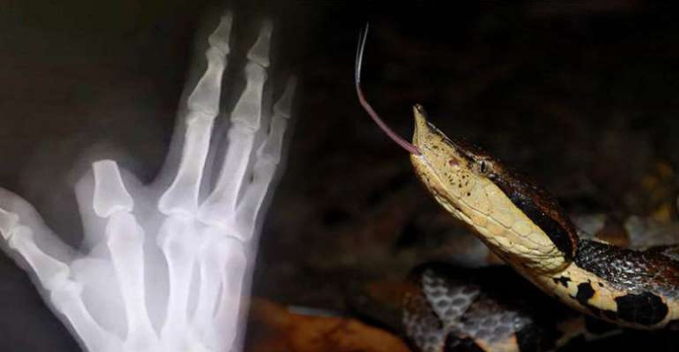 Man cut his own finger after snake bite | Oneindia Malayalam
