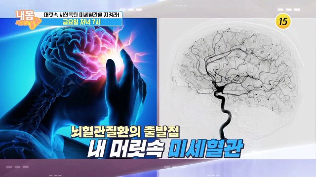 뇌혈관질환의 출발점 머릿속 미세혈관을 지켜라!_내 몸 사용설명서 275회 예고