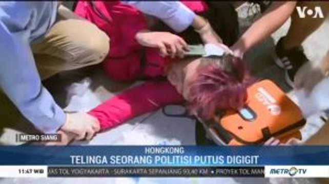 Telinga Politisi Hong Kong Putus Digigit