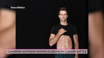 Cameron Mathison Shows Off Scars from His 'Scary' Battle with Kidney Cancer: 'There Was Such a Lack of Control'