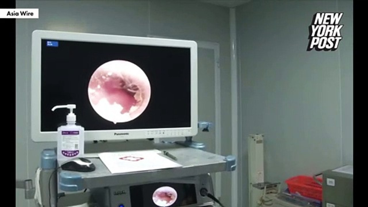 Une famille de cafards trouvée dans l'oreille d'un homme