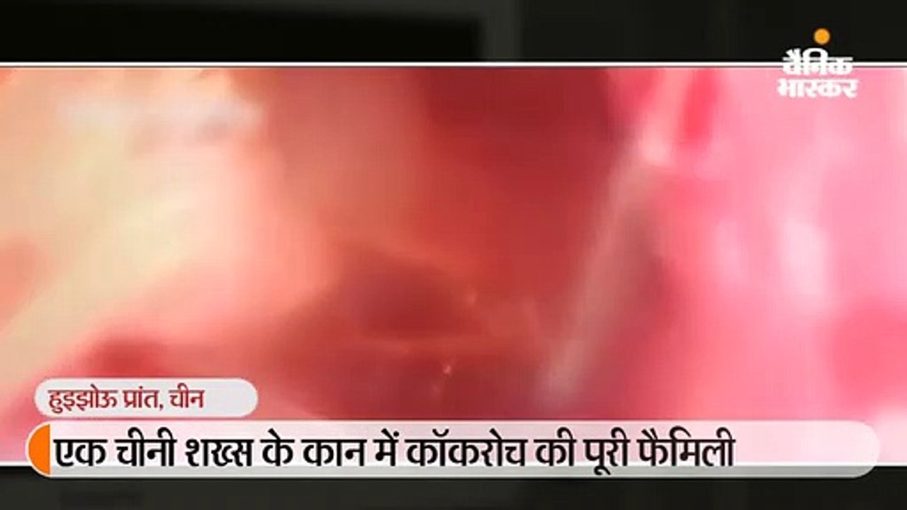 24 साल के युवक ने कान में कुछ चलने की शिकायत की...