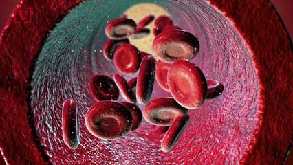 Scientists Discover New Strain of HIV for the First Time in Nearly 20 Years