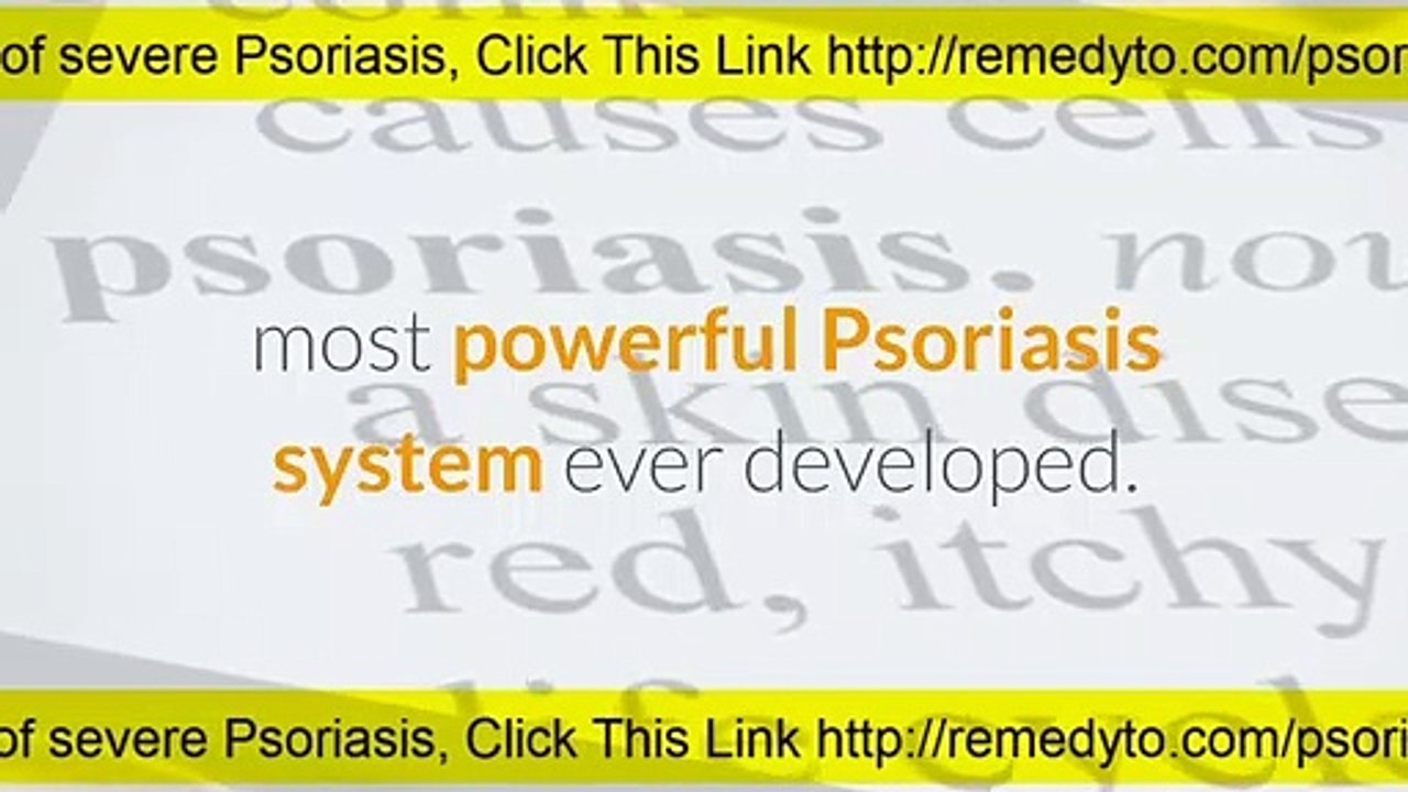 How To Cure Psoriasis Naturally Permanently- Stop Itching and Remove Psoriasis Marks From Skin