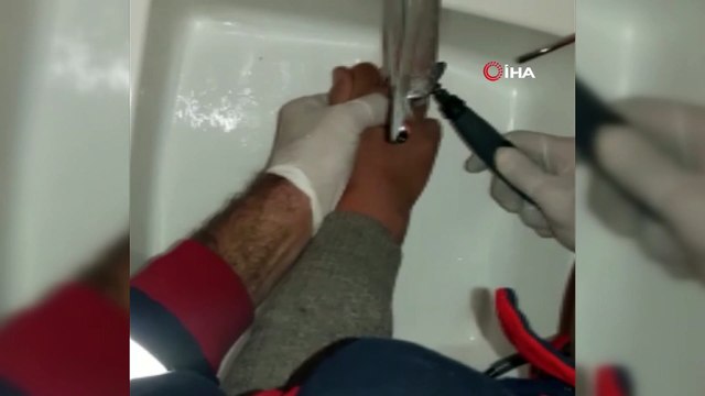 Parmağında sıkışan yüzüğü itfaiye çıkardı