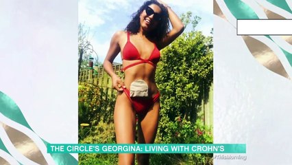 Raising Stoma Awareness