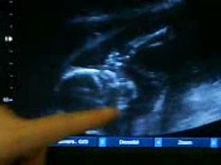 Liam 4eme echographie le 07.01.08