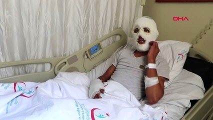 Erzurum arkadaşı sobaya tiner dökünce yüzü ve eli yandı