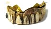 Golden Gums! 200-Year-Old Gold Teeth Made of Ivory & Gold Set to Go for Thousands at Auction!