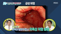 [HEALTH] Older indigestion results in stiffness in the stomach?, 기분 좋은 날 20191112