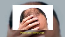 Best Hair Transplant Surgeon Philadelphia - Pistone Hair Restoration (888) 260-3270