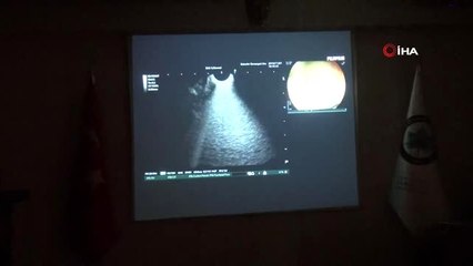 Canlı yayınlanan endoskopik işlem ile kurs verildi