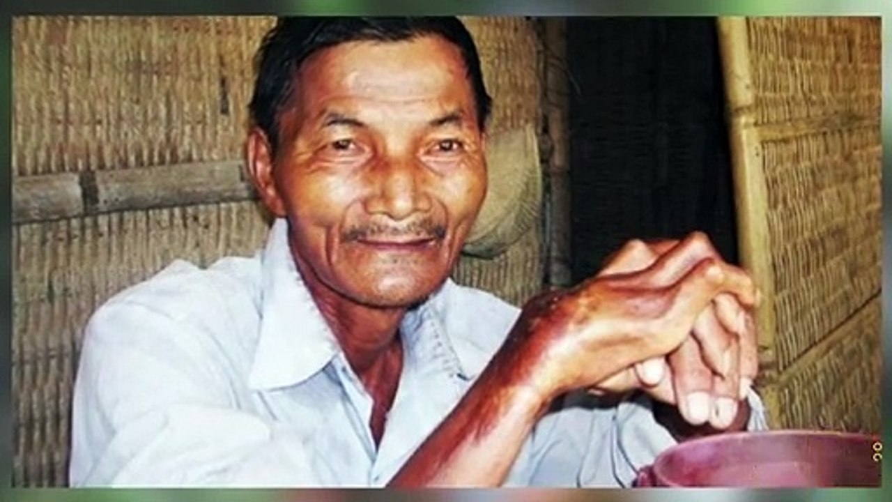 தூக்கம் என்றால் என்ன? உலகின் தூங்காத மனிதர்..!