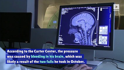 Jimmy Carter Experiences ‘No Complications’ During Brain Surgery