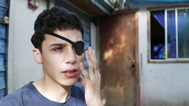 Lesiones oculares y ceguera, marcas indelebles de las protestas en Chile