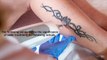 How the Laser seems to be an Effective Procedure for Removing Tattoos