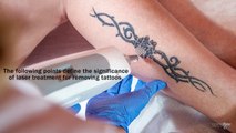 How the Laser seems to be an Effective Procedure for Removing Tattoos