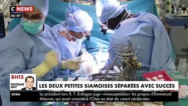 Lyon: Les images impressionnantes de la délicate opération qui a permis de séparer hier deux petites siamoises
