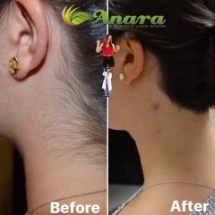 It’s always great to get rid of UNWANTED hair from any area of the body