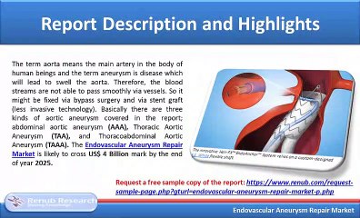 Endovascular Aneurysm Repair Market, Global Forecast by Stent Graft (2019 -2025)