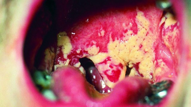 Dill worlds best healthiest food nutritional facts, uses, side effects-Nuturemite English