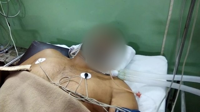 मेरठः पैंट में फंसा रखी थी पिस्टल, डांस करते टाइम दब गया ट्रिगर और प्राइवेट पार्ट में जा फंसी गोली
