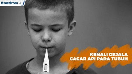 Kenali Gejala Cacar Api pada Tubuh