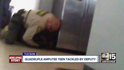 Video of Arizona deputy restraining teen amputee spurs probe