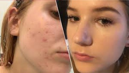 ದೇಹಕ್ಕೆ ಹಚ್ಚುವ ಬಾಡಿ ಲೋಷನ್ ಮುಖಕ್ಕೆ ಹಚ್ಚಿದ್ರೆ ಏನಾಗುತ್ತೆ? | Oneindia Kannada