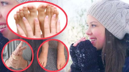 Скачать видео: सर्दियों में उंगलियों की सूजन दूर करेंगे ये घरेलू उपाय | Finger Swelling remedies in Winter |Boldsky