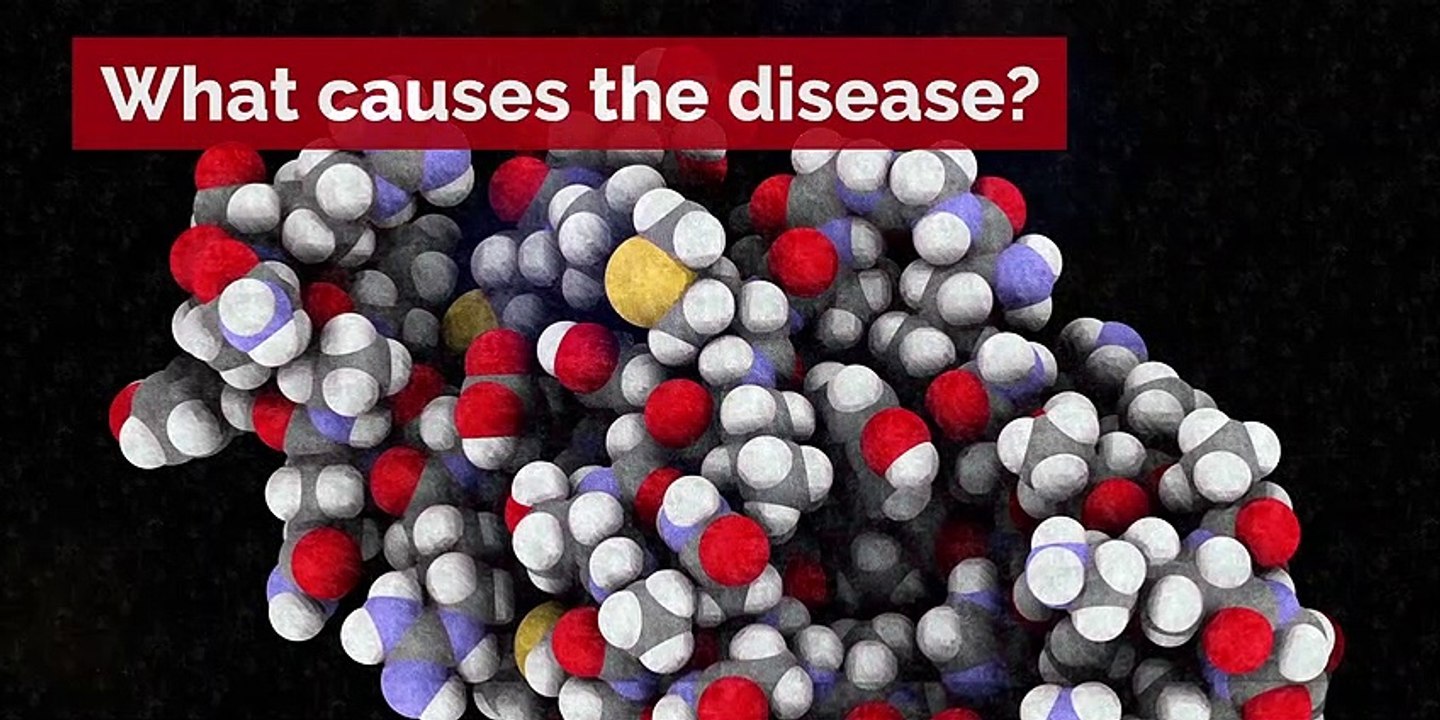 Mad cow disease - Here's everything you need to know about 'mad cow disease'