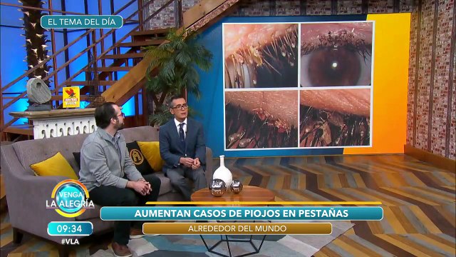 ¿Piojos en pestañas postizas? Qué cuidados tener para evitarlos. | Venga La Alegría