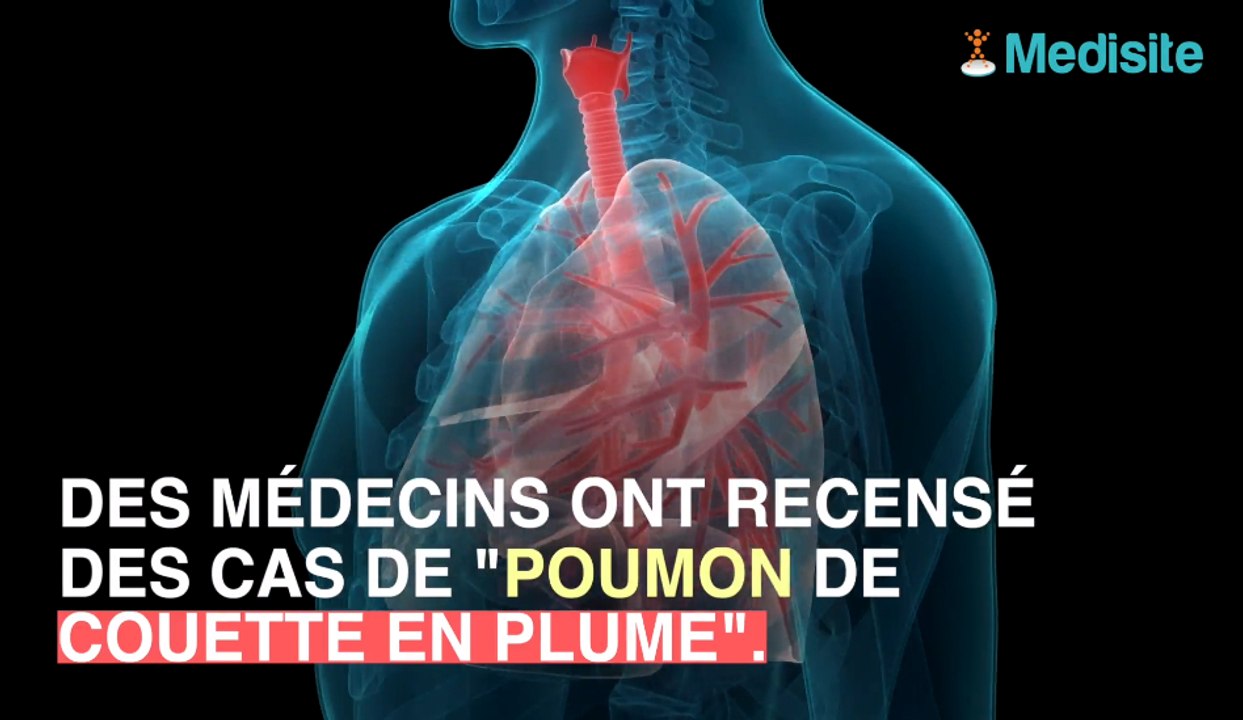 Les couettes et oreillers à plumes, un danger pour vos poumons !