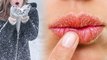 Winter Lip Care Tips | Home Remedies | सर्दियों में ऐसे रखें होठों का ध्यान | Boldsky
