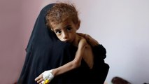 حمى الضنك شبح يهدد أهالي مدينة تعز اليمنية