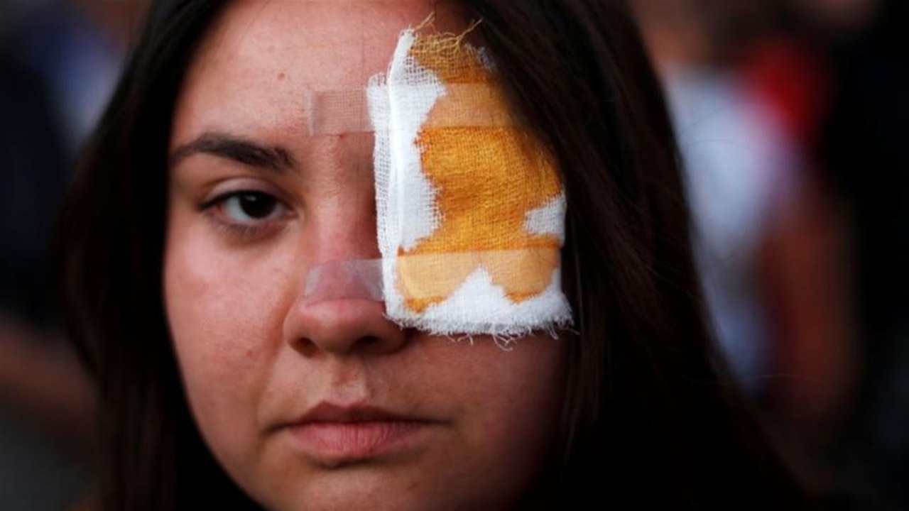 Chile police suspend use of rubber bullets over eye injuries