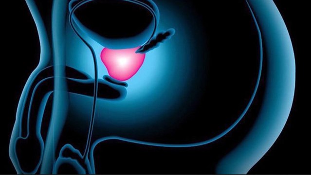 bd-peligro-de-crecimiento-de-prostata-201119