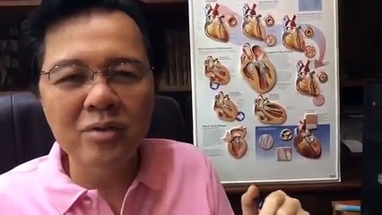 Mabilis Tibok ng Puso, Sakit sa Dibdib, Hirap Huminga - ni Doc Willie at Liza Ong