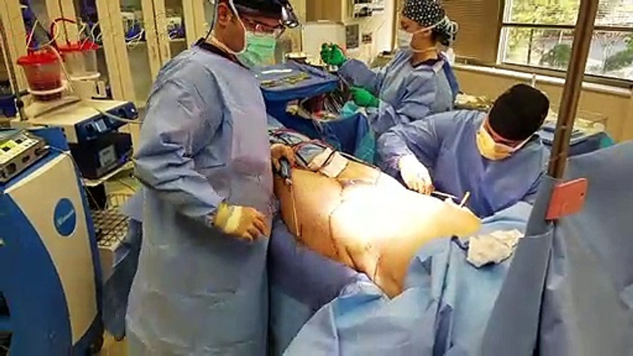 How to get rid of armpit fat