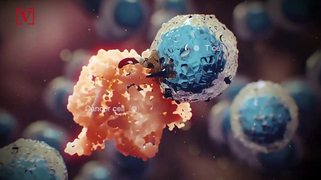 Anal Cancer Rising Among Some White Women And Black Men