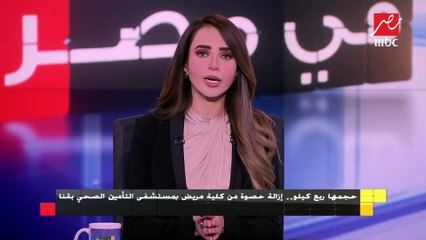 إزالة حصوة من كلية مريض (حجمها ربع كيلو) بمستشفى التأمين الصحي بقنا.. تعرف على التفاصيل